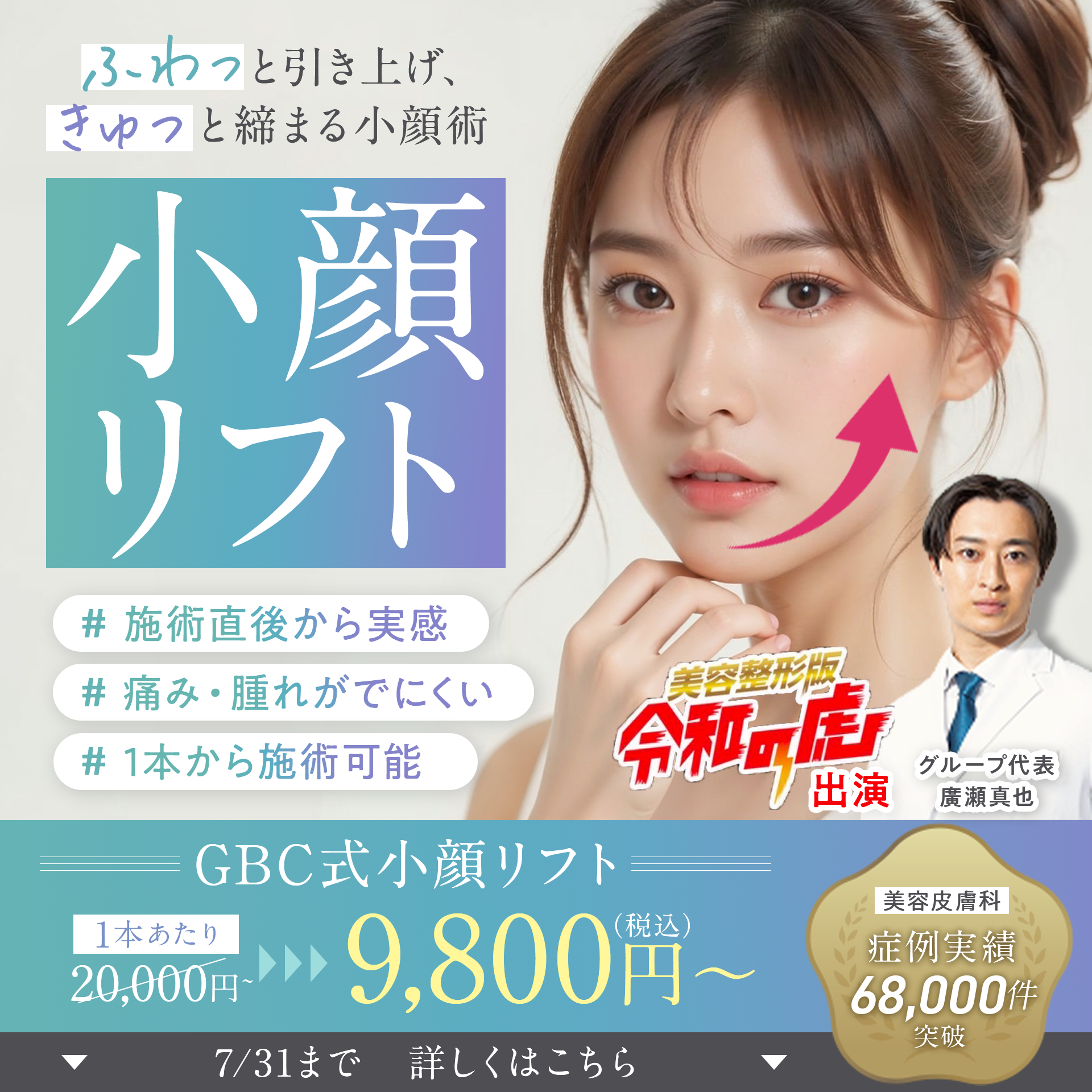 小顔リフト