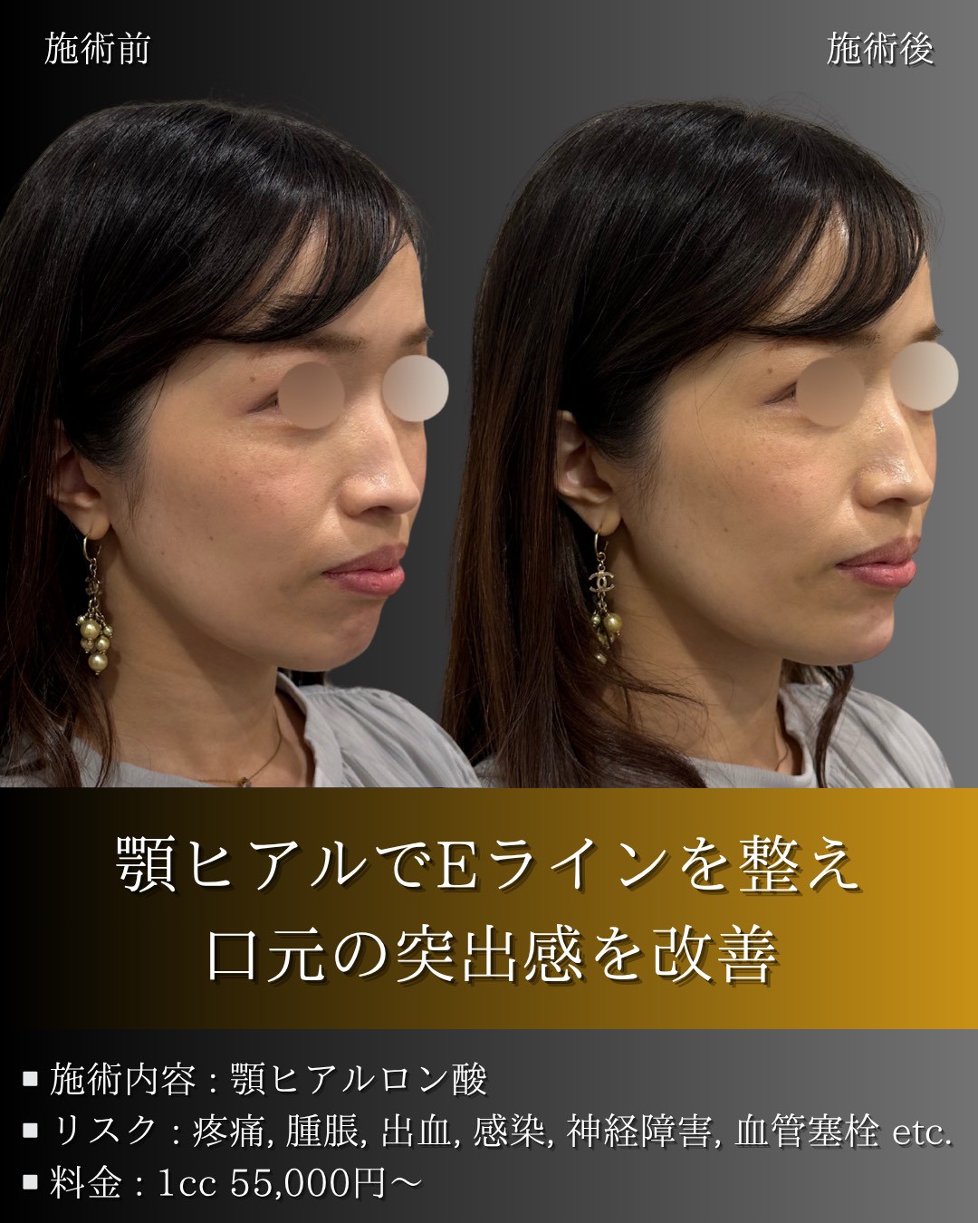 LINE_ALBUM_症例写真(大分・小倉)_251127_1