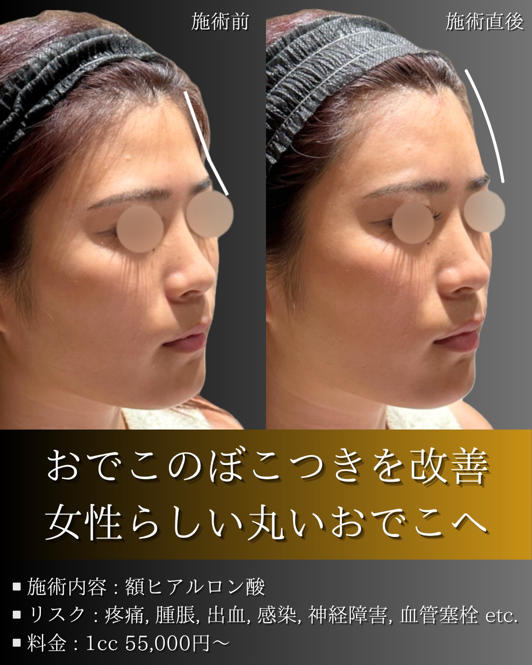 LINE_ALBUM_症例写真(大分・小倉)_251127_10