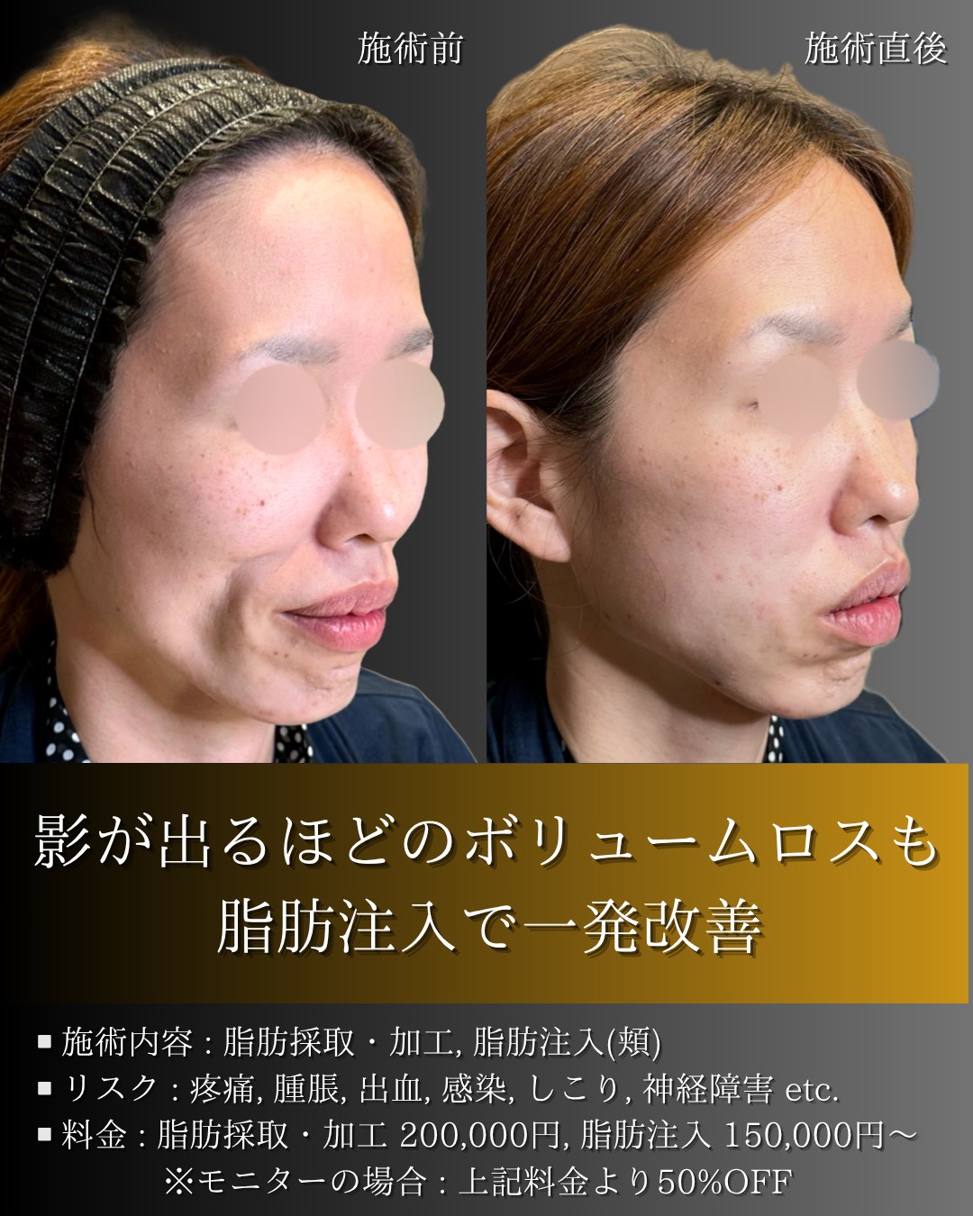 LINE_ALBUM_症例写真(大分・小倉)_251127_11