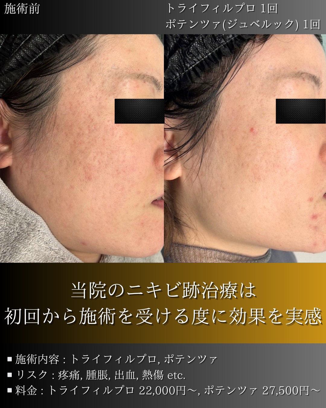 LINE_ALBUM_症例写真(大分・小倉)_251127_12