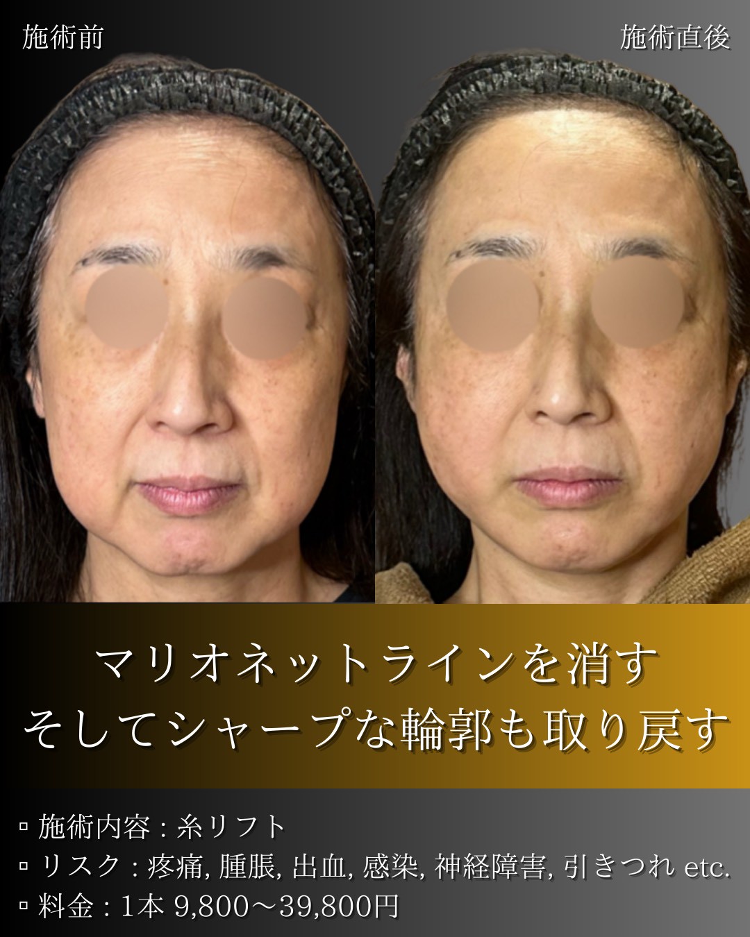 LINE_ALBUM_症例写真(大分・小倉)_251127_13