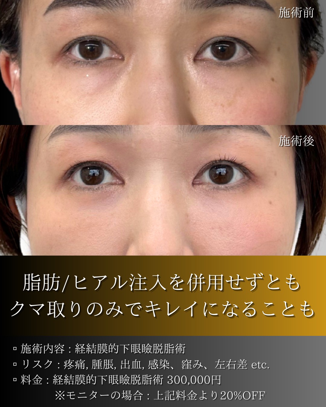 LINE_ALBUM_症例写真(大分・小倉)_251127_14