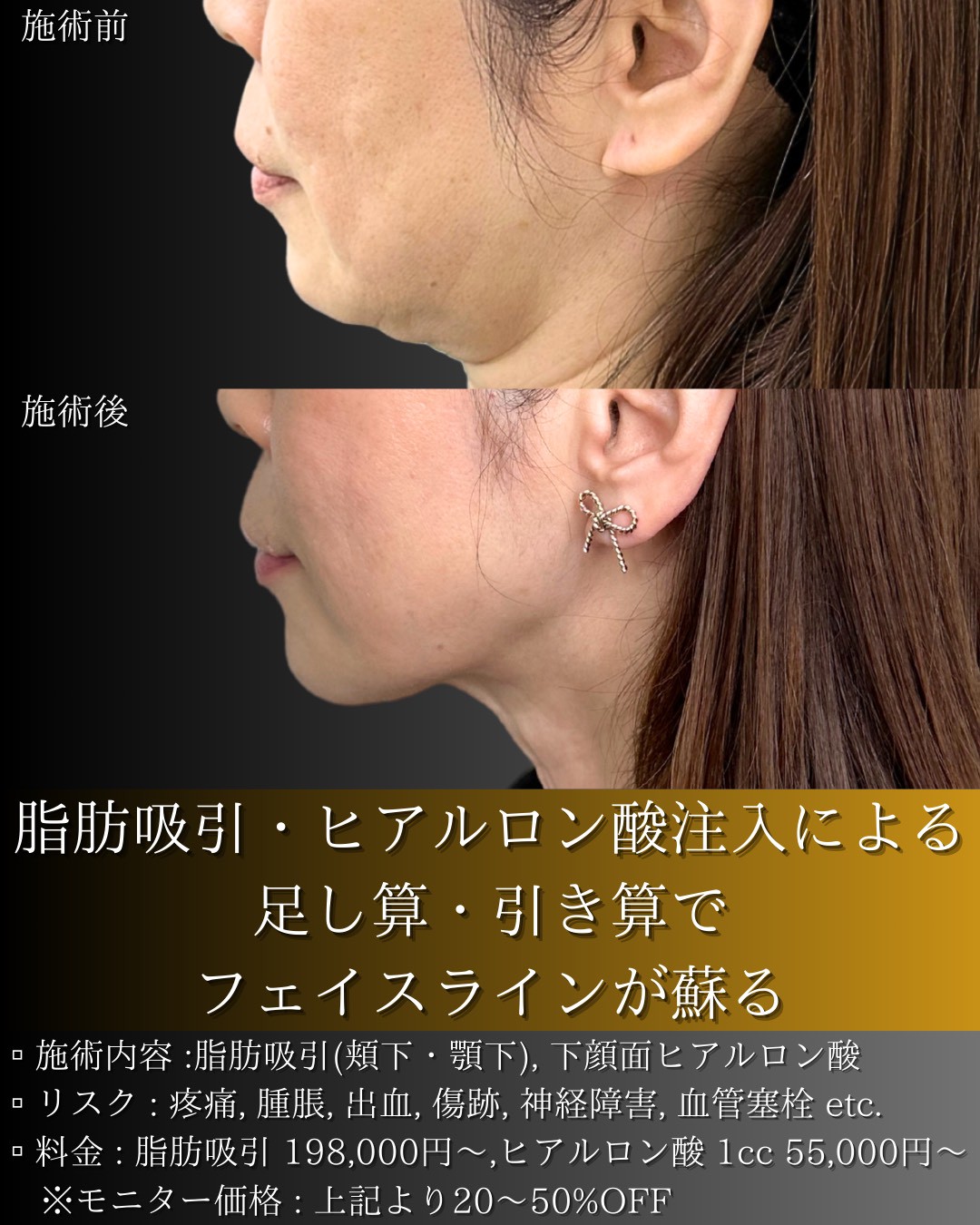 LINE_ALBUM_症例写真(大分・小倉)_251127_15