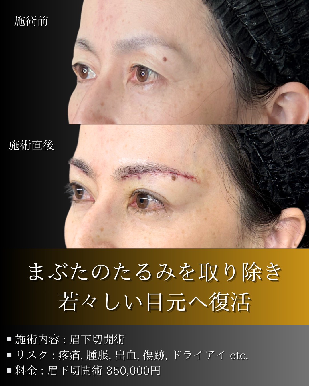 LINE_ALBUM_症例写真(大分・小倉)_251127_2