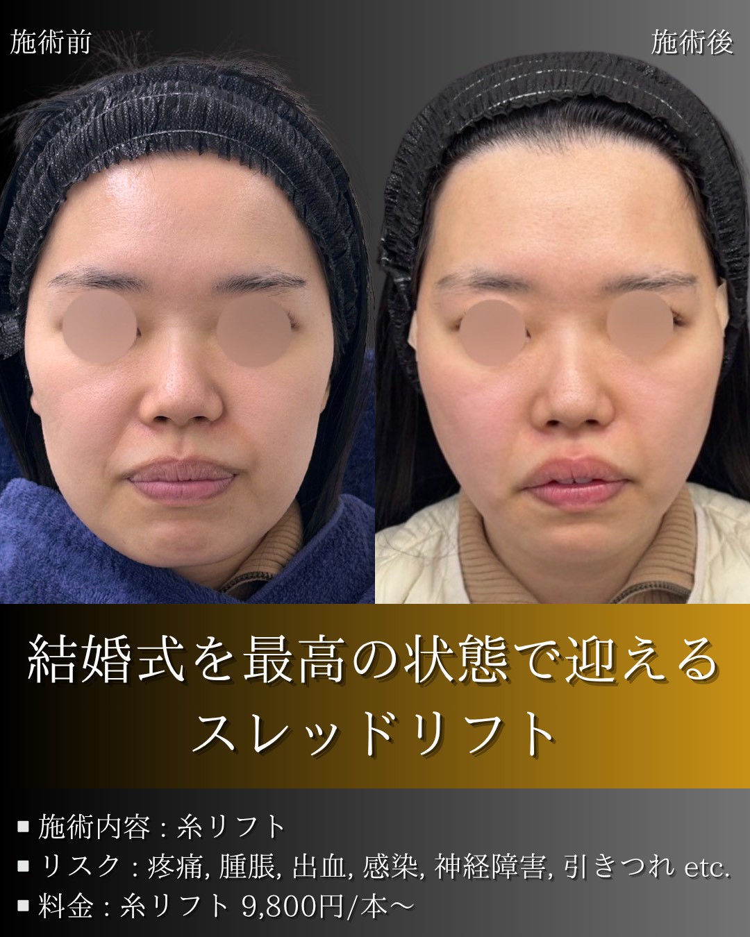 LINE_ALBUM_症例写真(大分・小倉)_251127_3