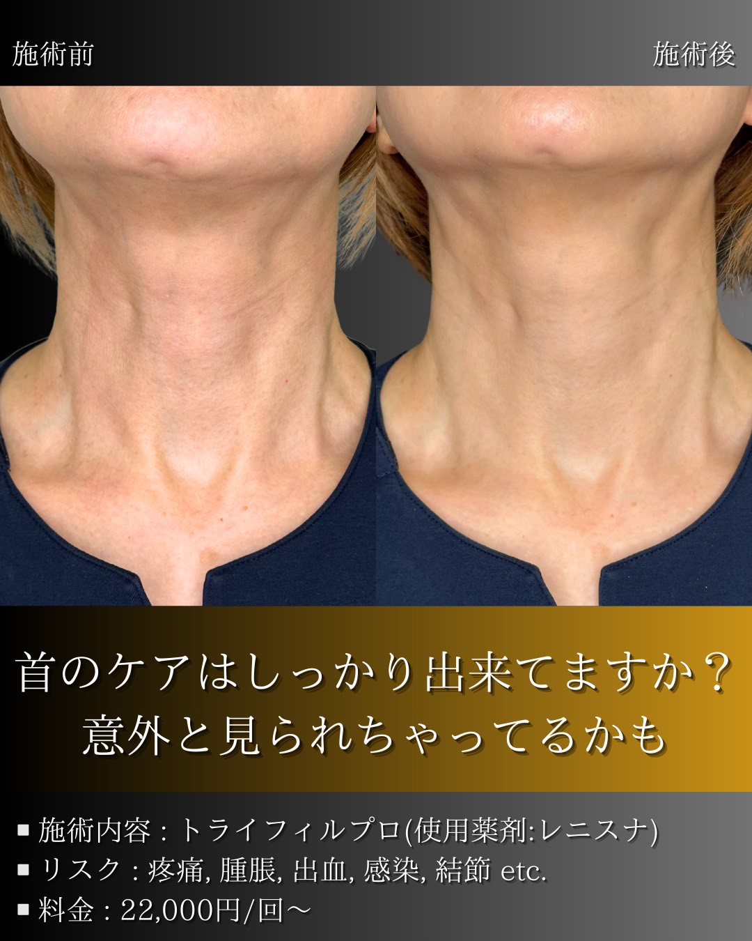 LINE_ALBUM_症例写真(大分・小倉)_251127_4