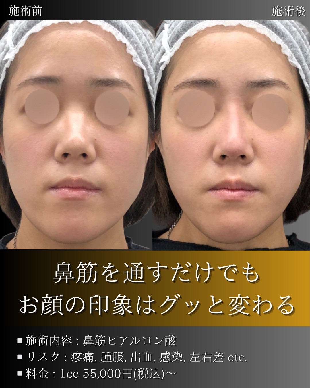 LINE_ALBUM_症例写真(大分・小倉)_251127_5