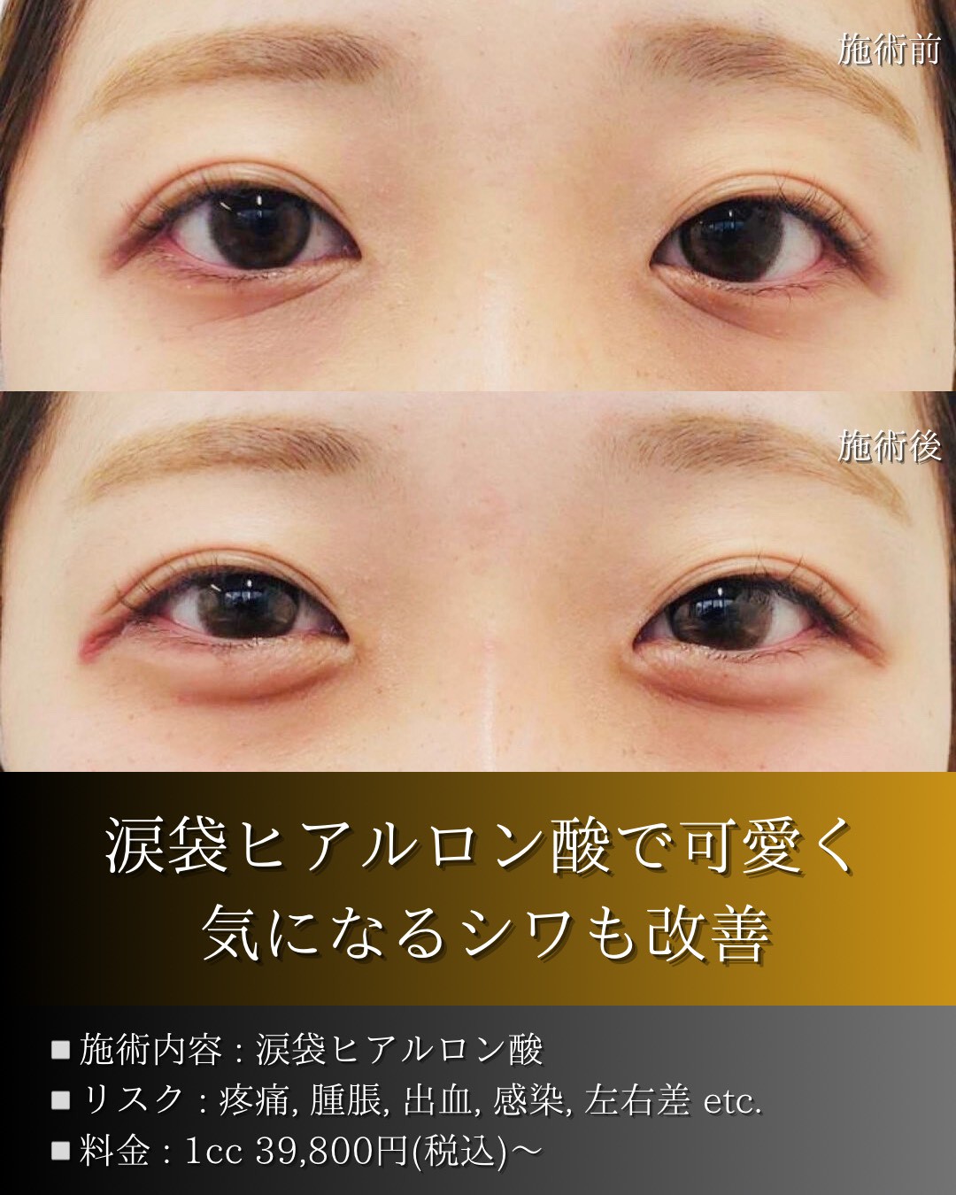 LINE_ALBUM_症例写真(大分・小倉)_251127_6