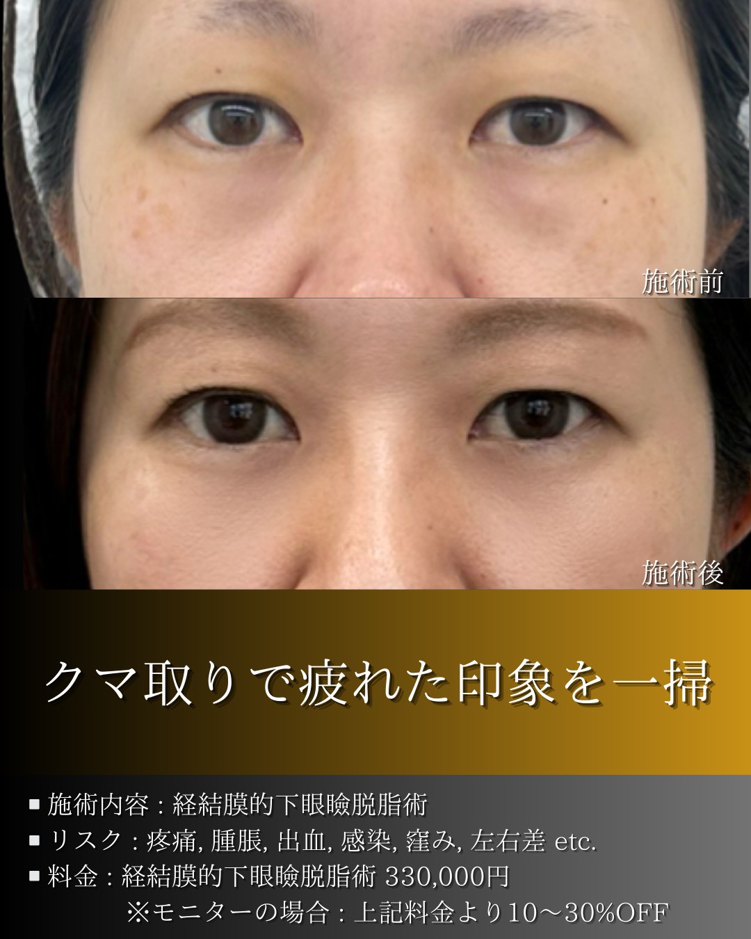 LINE_ALBUM_症例写真(大分・小倉)_251127_7