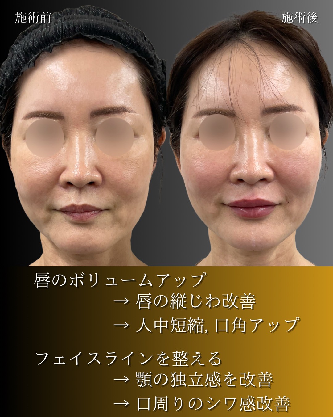 LINE_ALBUM_症例写真(大分・小倉)_251127_8