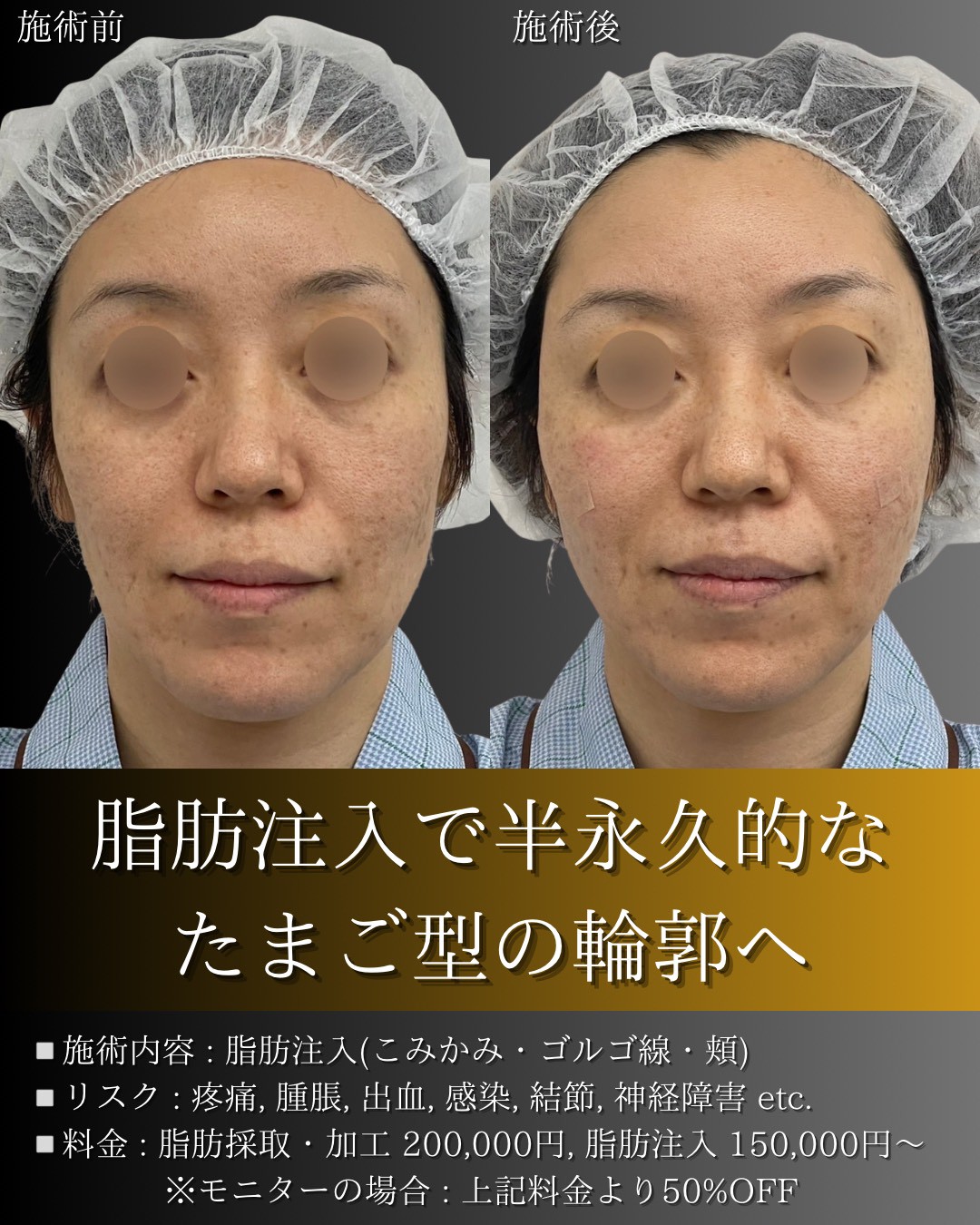 LINE_ALBUM_症例写真(大分・小倉)_251127_9