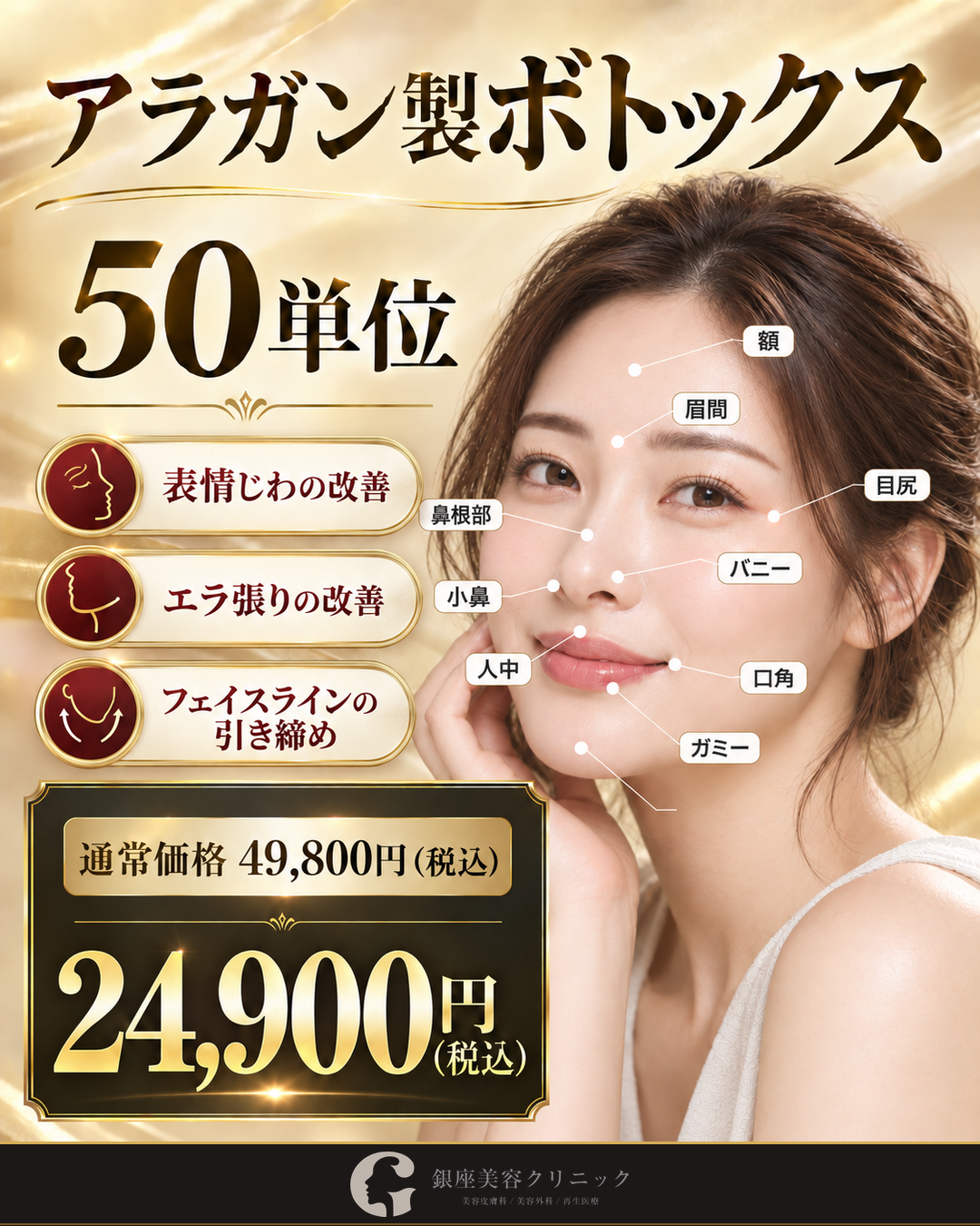 アラガン製ボトックス 50単位